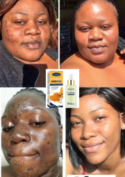 ✨ Offre Spéciale Beauty Face : 1 Sérum Turmeric acheté = 1 Savon Turmeric OFFERT ! ✨