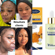 ✨ Offre Spéciale Beauty Face : 1 Sérum Turmeric acheté = 1 Savon Turmeric OFFERT ! ✨